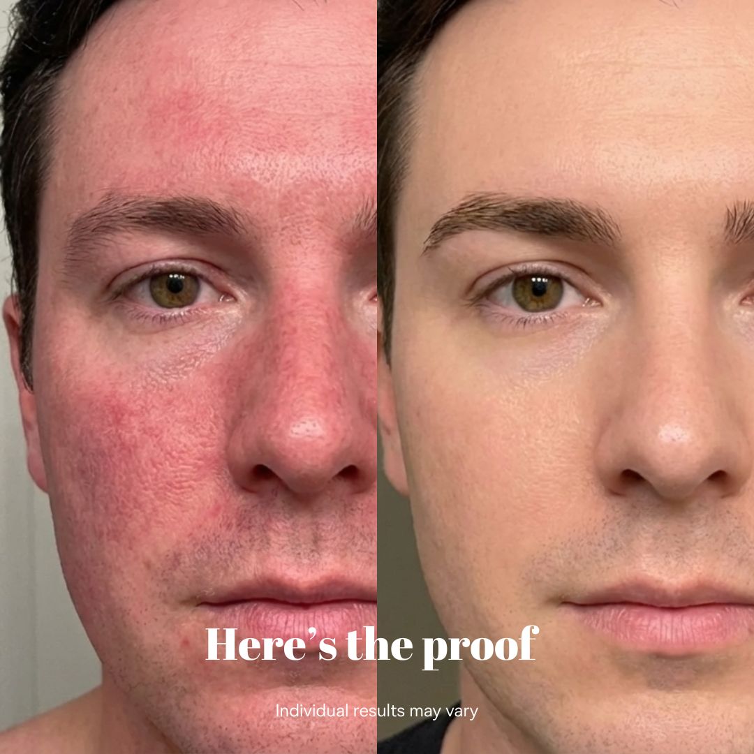 Copper Peptide Recovery Serum - GHK-Cu Formula