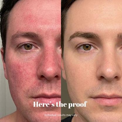 Copper Peptide Recovery Serum - GHK-Cu Formula